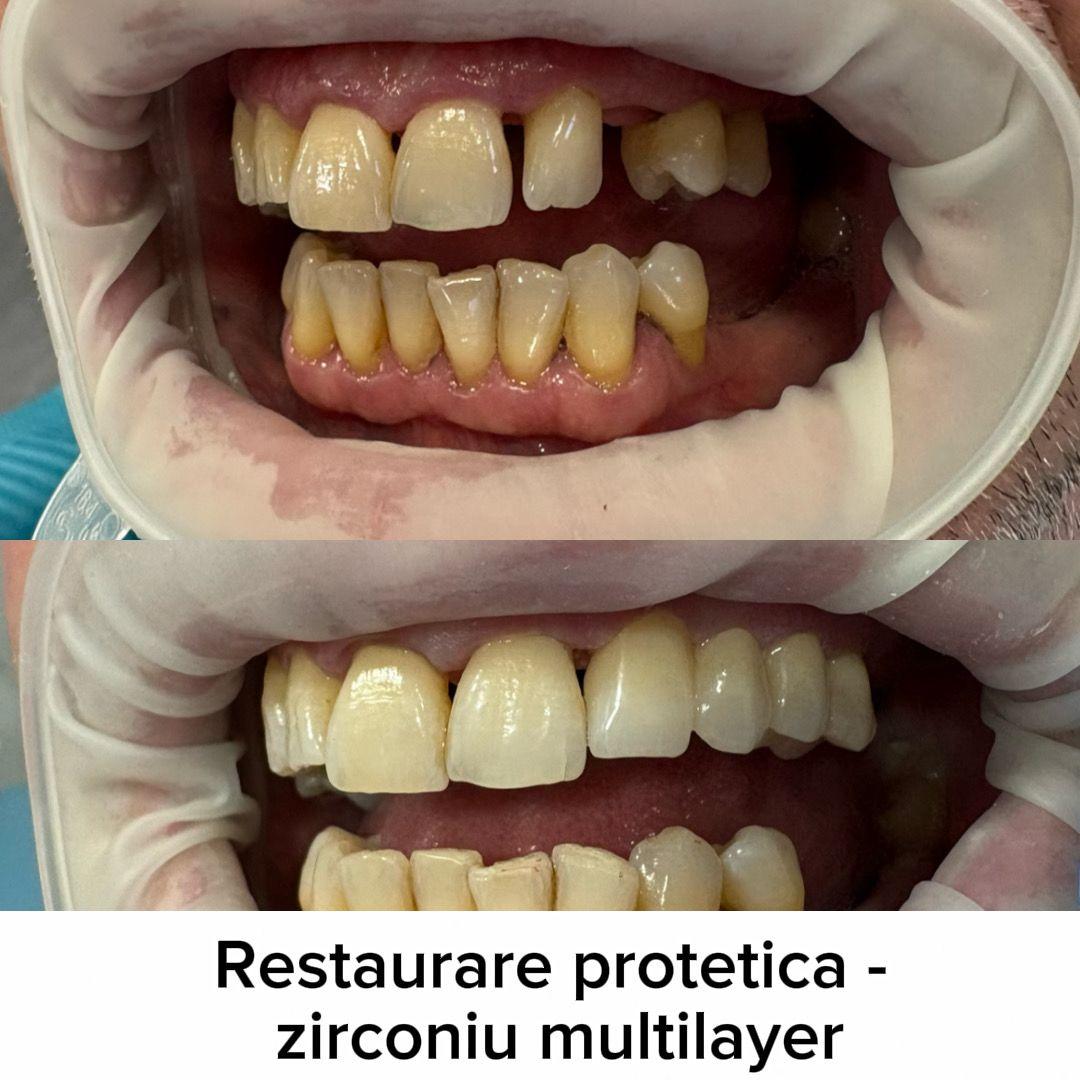 Miniatură portofoliu