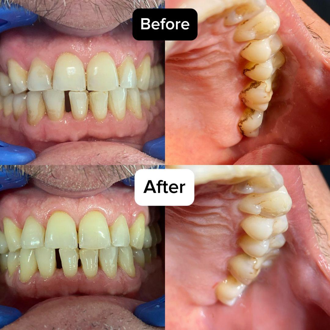 Miniatură portofoliu